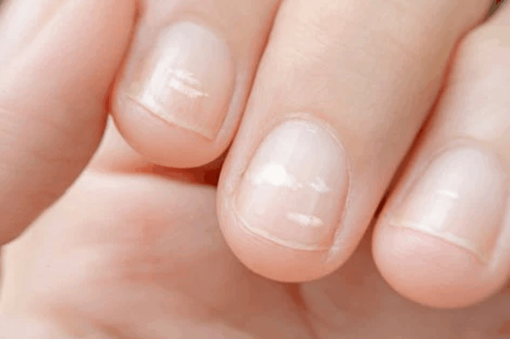 Einfluss von Medikamenten auf Nagelgesundheit