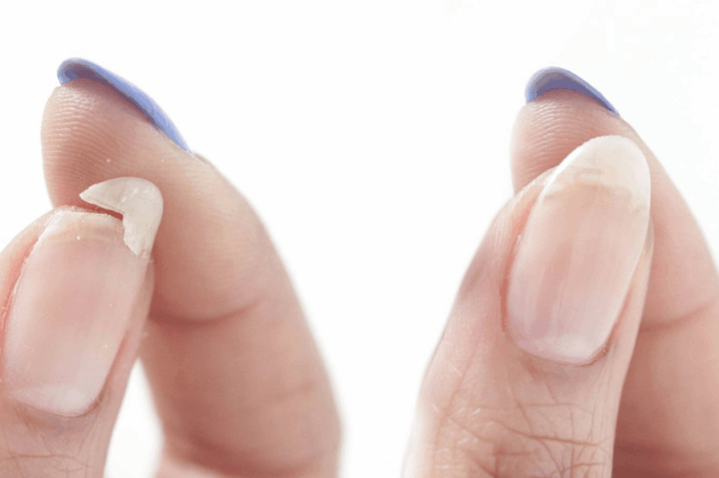 Hygiene bei Nagelwerkzeugen zur Vorbeugung von Nagelkrankheiten