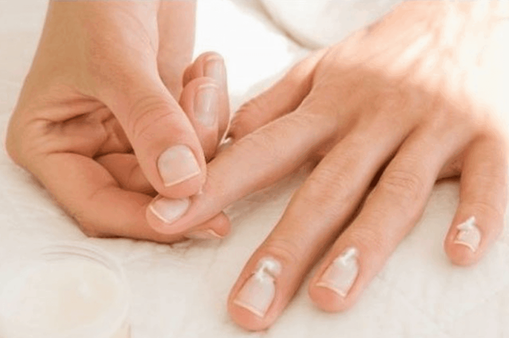 splitternde fingernägel als Hinweis auf Gesundheitsprobleme